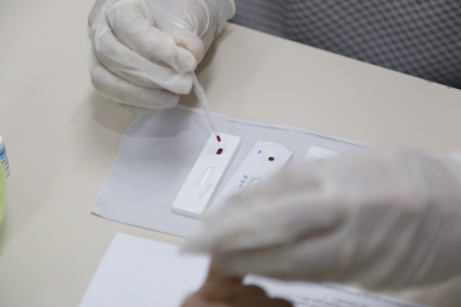 Aleses Mitarbeiter testen auf Syphilis, HIV und Virushepatitis